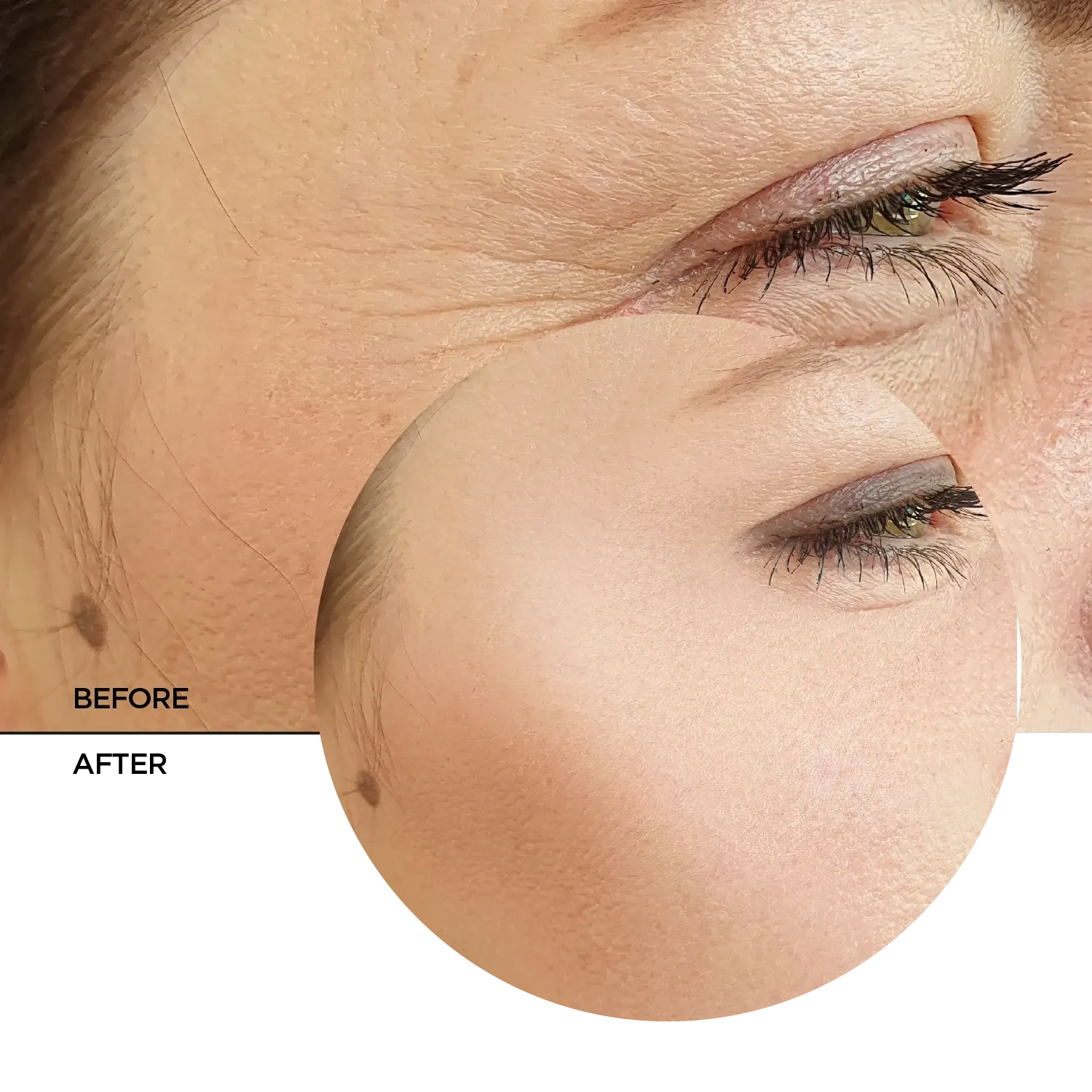 Retinol 0.3%   Niacinamide 5%